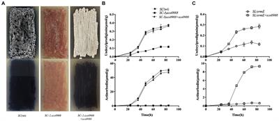The acetyltransferase SCO0988 controls positively specialized metabolism and morphological differentiation in the model strains Streptomyces coelicolor and Streptomyces lividans